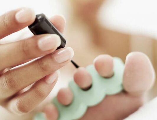 nagu apstrāde ar nagu laku sēnīšu infekcijas gadījumā